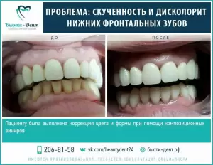 Фотография Бьюти Дент 5