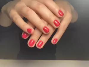 Фотография Доступная стоматология 5